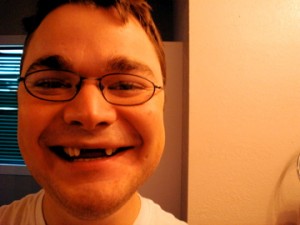 Toothless Wonder